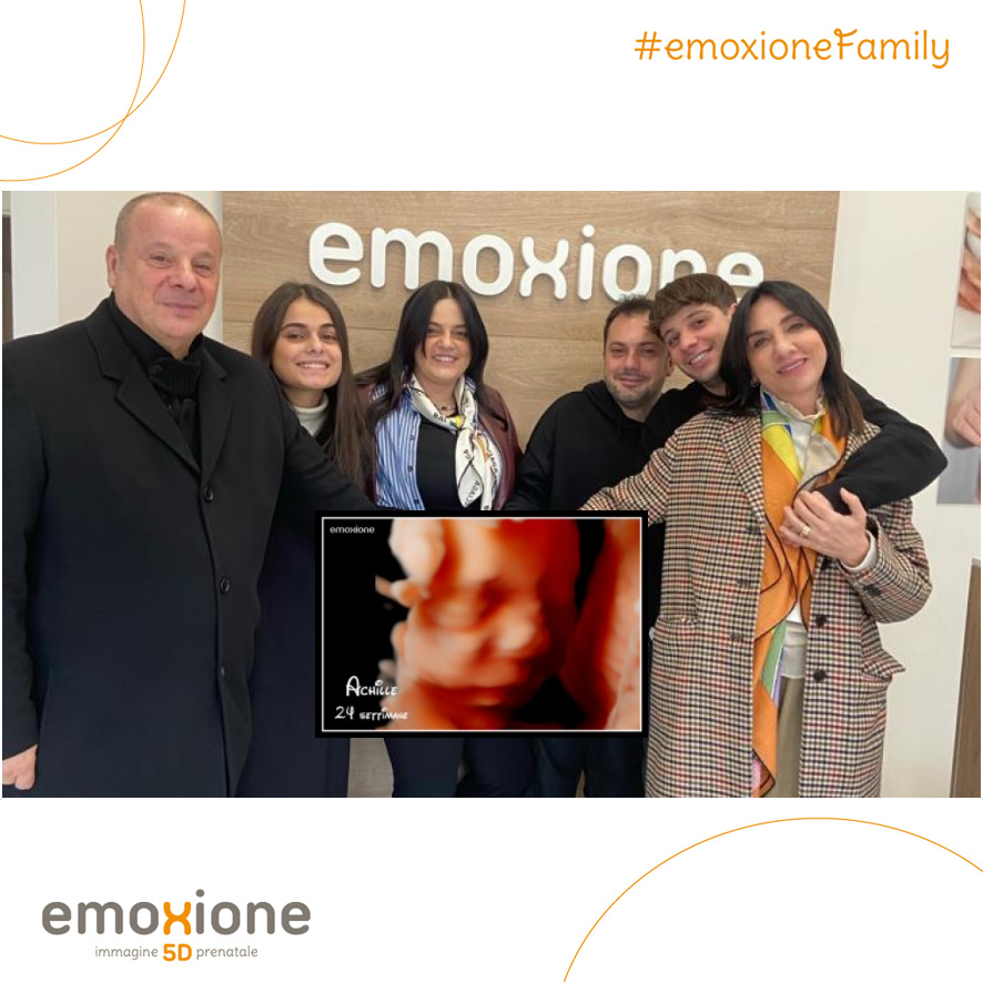 Ecografia emozionale Ecografia 4D di Cristina Marzioni