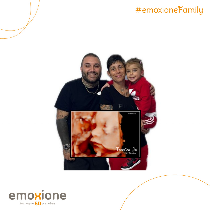 Ecografia emozionale Ecografia 4D di Shony Cocola