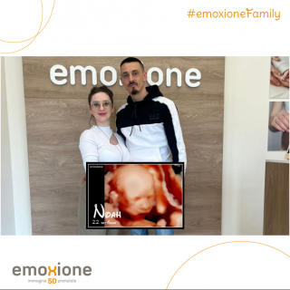 Ecografia emozionale Ecografia 4D di Anxhela Kokoneshi