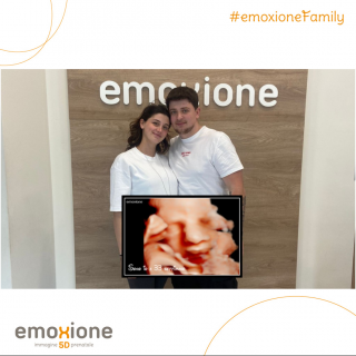Ecografia emozionale Ecografia 4D di Koka Jessica
