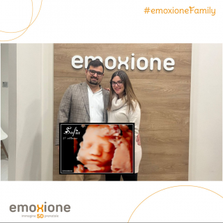 Ecografia emozionale Ecografia 4D di Buono Laura