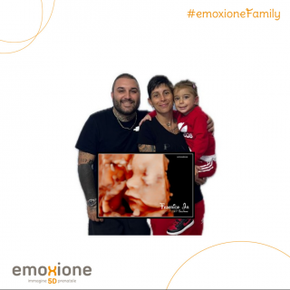 Ecografia emozionale Ecografia 4D di Shony Cocola
